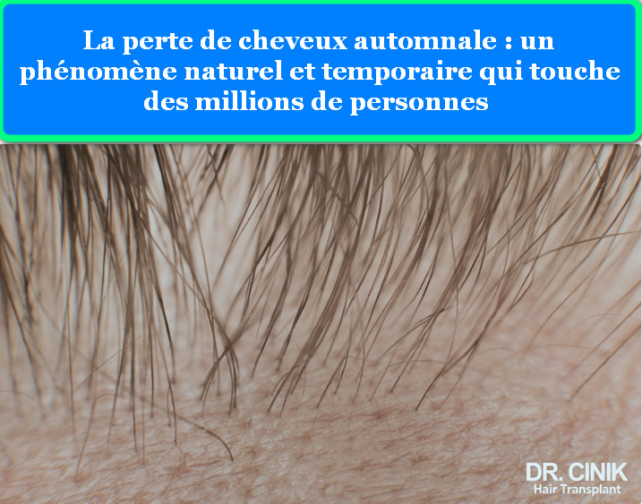 La perte de cheveux automnale un phénomène naturel et temporaire qui touche des millions de personnes