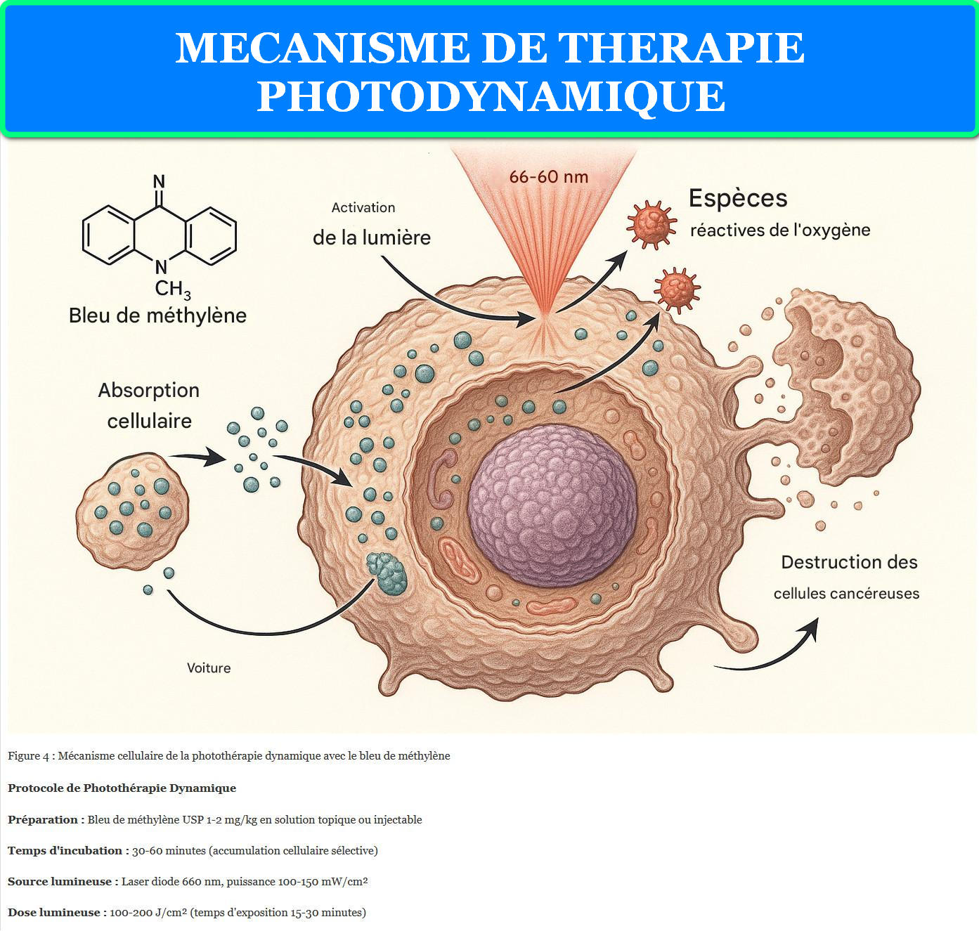 MECANISME DE THERAPIE PHOTODYNAMIQUE